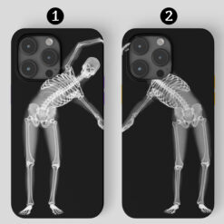 Çift Kalp Yapan İskeletler Tasarımlı Silikon Telefon Kılıfı