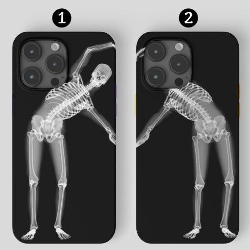Çift Kalp Yapan İskeletler Tasarımlı Silikon Telefon Kılıfı