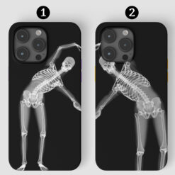 Çift Sevgili İskeletler Tasarımlı Baskılı Telefon Kılıfı