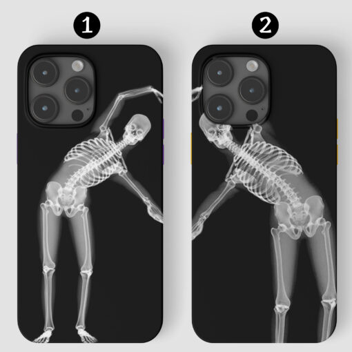 Çift Sevgili İskeletler Tasarımlı Baskılı Telefon Kılıfı